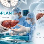 Understanding Liver Transplant